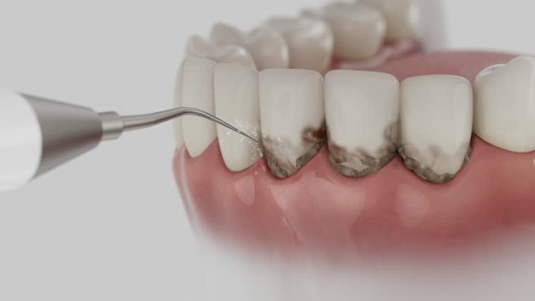 Trusted Dental Crowns And Bridges service in Galesburg, MI - Dentist Open Now